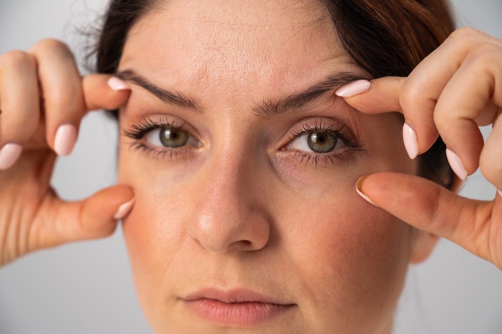 Close up of a woman holding her eyes open to show the effects of an upper and lower blepharoplasty.
